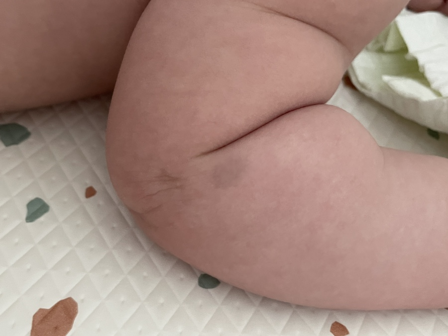 아이엠피부과의원 (I Am Dermatology Clinic), photo 6